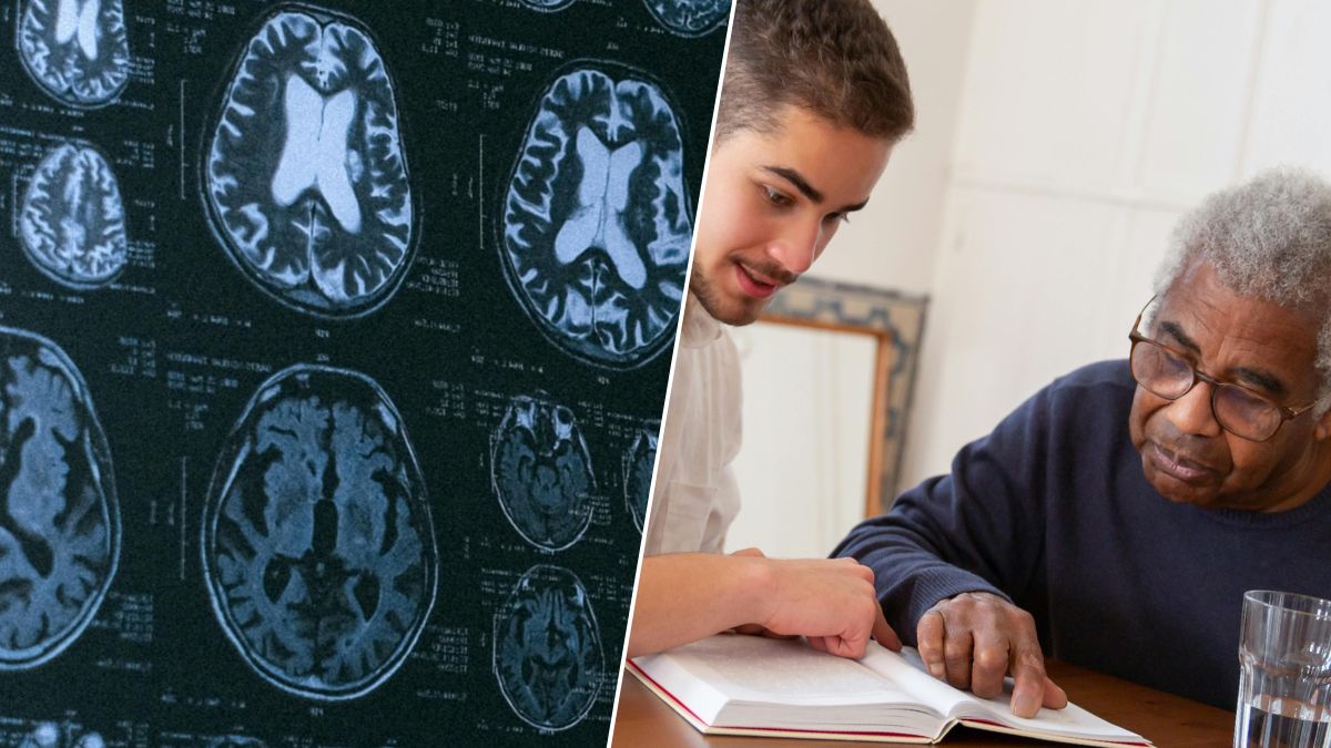 Maladie d’Alzheimer : 3 signes précoces à repérer avant les troubles de la mémoire