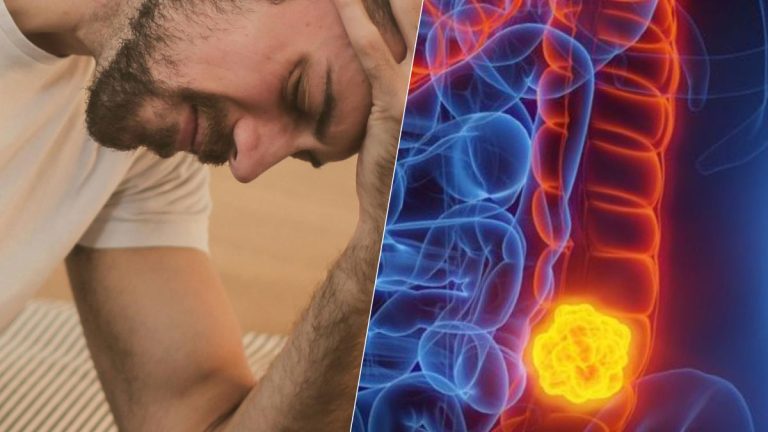 Cancer colorectal : ces signes discrets à tout âge que les médecins vous demandent de ne jamais ignorer