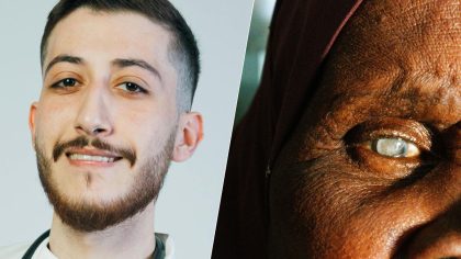 Cataracte : ce que les médecins ne disent pas toujours sur cette maladie très fréquente