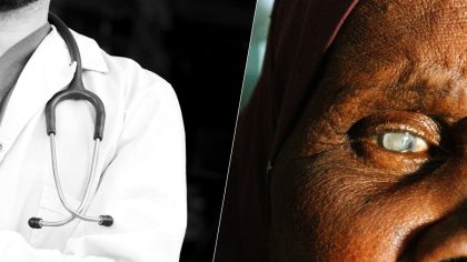 Cataracte : causes méconnues de la vision floue