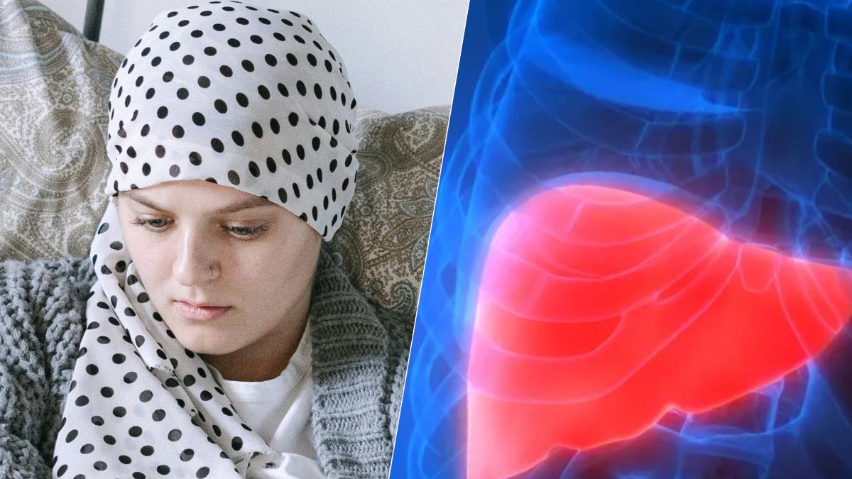 Cancer du foie : les symptômes de cette maladie